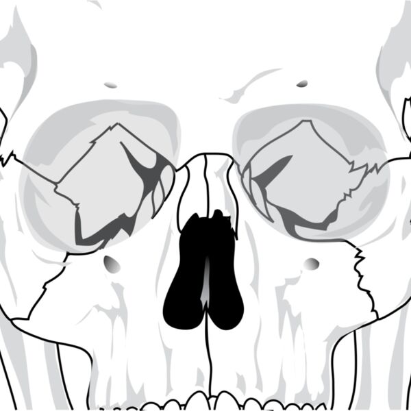 liftarn Human skull 2 Thumbnail